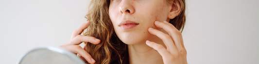 Hyaluronsäure bei trockener Haut – HATTS Naturkosmetik aus dem Allgäu erklärt Wirkung und Anwendung